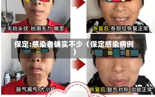 保定:感染者确实不少（保定感染病例）