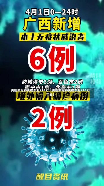 美国新冠肺炎确诊超241万（美国新冠肺炎确诊超241万了吗）-第1张图片-多讯网