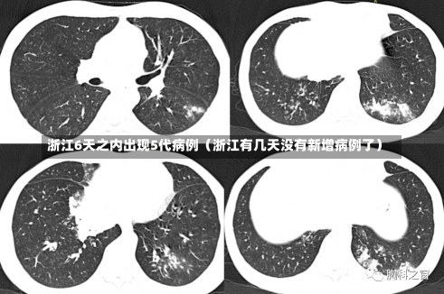 浙江6天之内出现5代病例（浙江有几天没有新增病例了）-第1张图片-多讯网