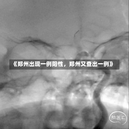 《郑州出现一例阳性，郑州又查出一例》-第1张图片-多讯网