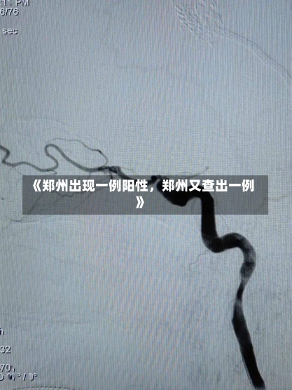 《郑州出现一例阳性，郑州又查出一例》-第3张图片-多讯网