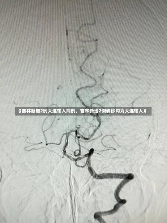 《吉林新增2例大连输入病例，吉林新增2例确诊均为大连输入》-第1张图片-多讯网