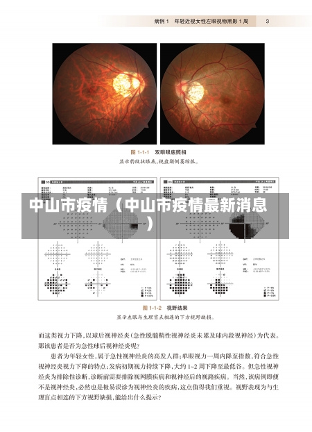 中山市疫情（中山市疫情最新消息）-第1张图片-多讯网